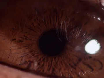 Ojo Ojo