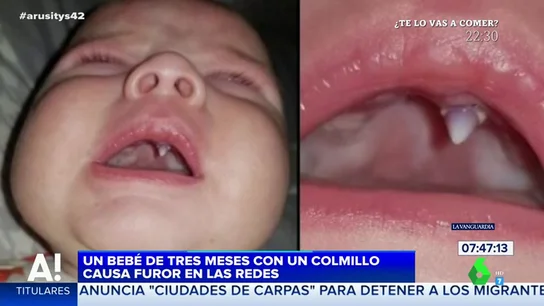 La sorprendente imagen de un bebé de tres meses con un colmillo que arrasa en Internet La sorprendente imagen de un bebé de tres meses con un colmillo que arrasa en Internet