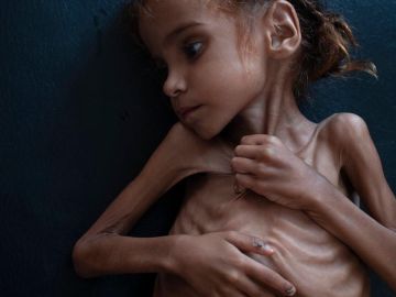 Muere la niña de siete años que puso rostro al drama de la guerra de Yemen Muere la niña de siete años que puso rostro al drama de la guerra de Yemen