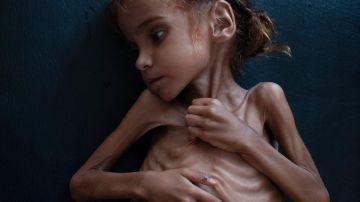 Muere la niña de siete años que puso rostro al drama de la guerra de Yemen