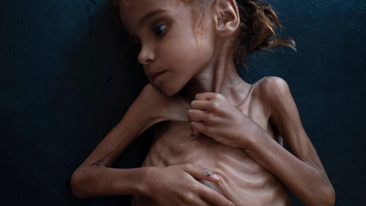 Muere la niña de siete años que puso rostro al drama de la guerra de Yemen