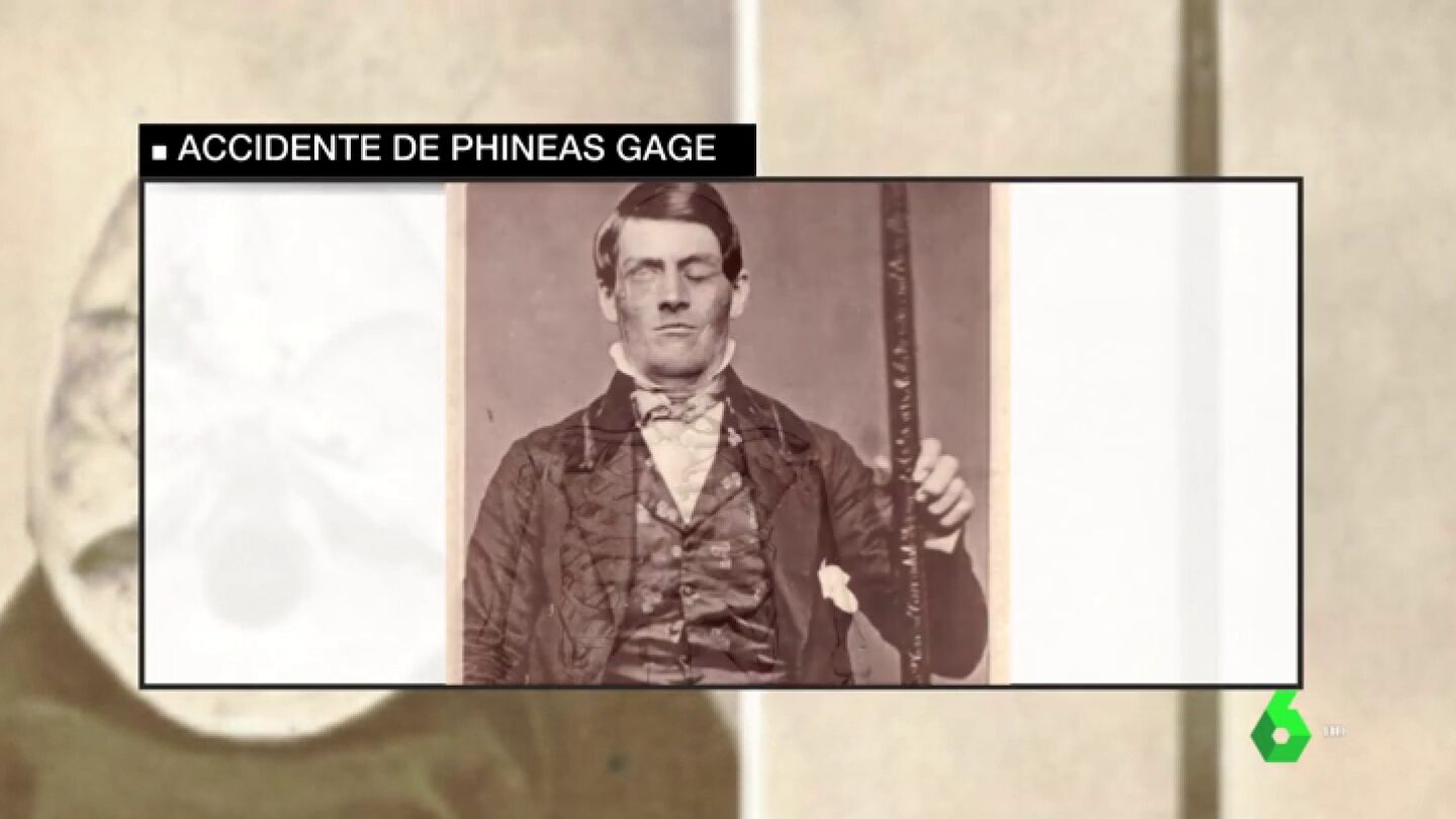 El caso de Phineas Gage que se compara con Patrick Nogueira: un da&ntilde;o en su cerebro cambi&oacute; radicalmente su conducta
