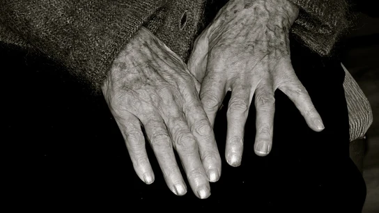 Manos de una anciana Manos de una anciana