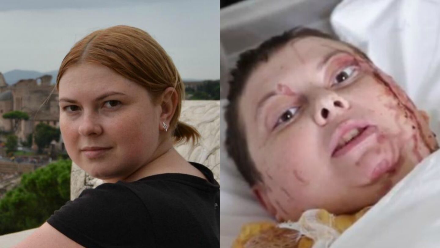 Kateryna Handziuk, la activista ucraniana