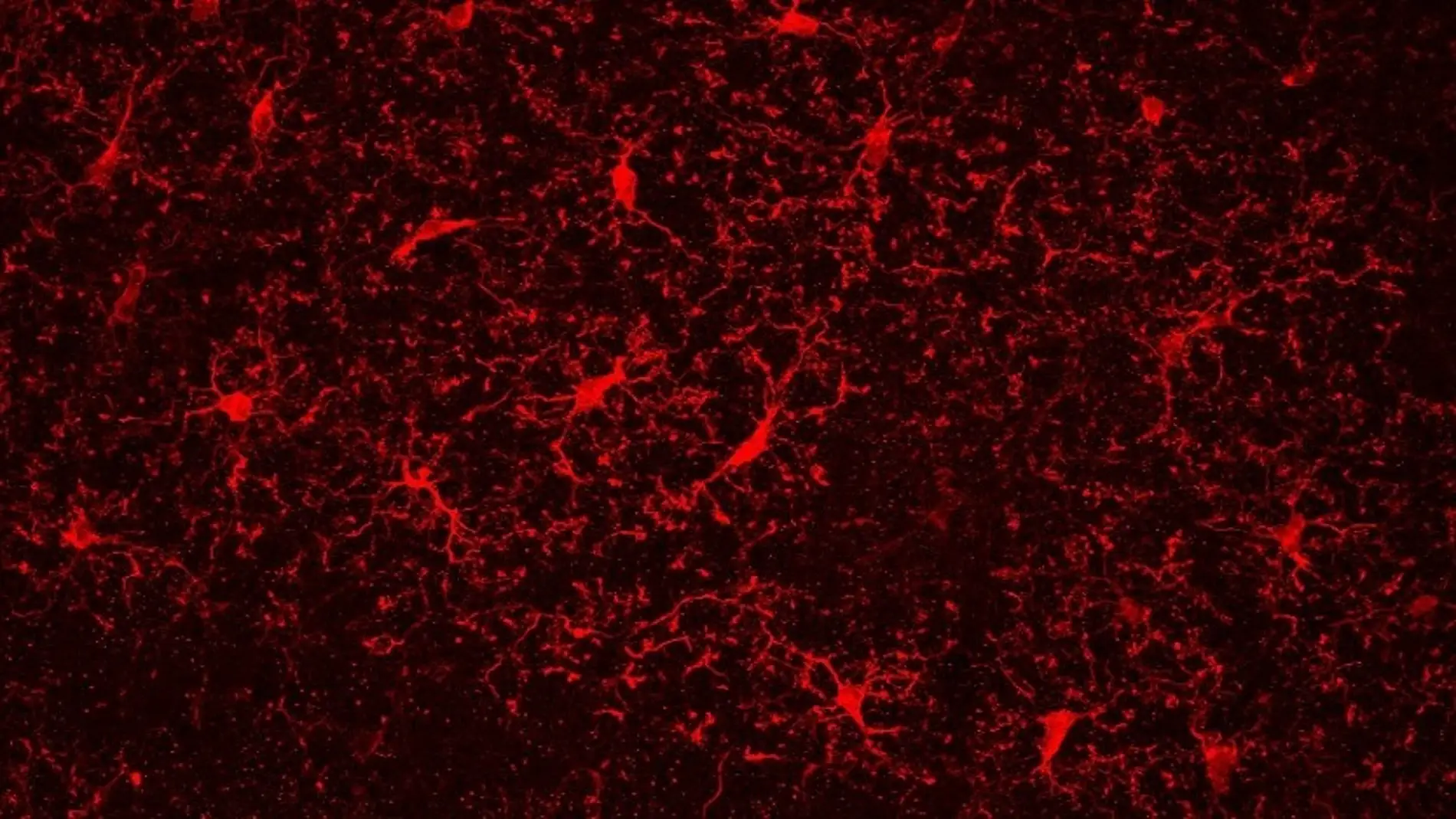 Antiinflamatorios para mejorar los problemas cognitivos por la abstinencia de la nicotina