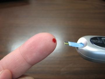 Una mutación genética da pistas para tratar la diabetes Una mutación genética da pistas para tratar la diabetes