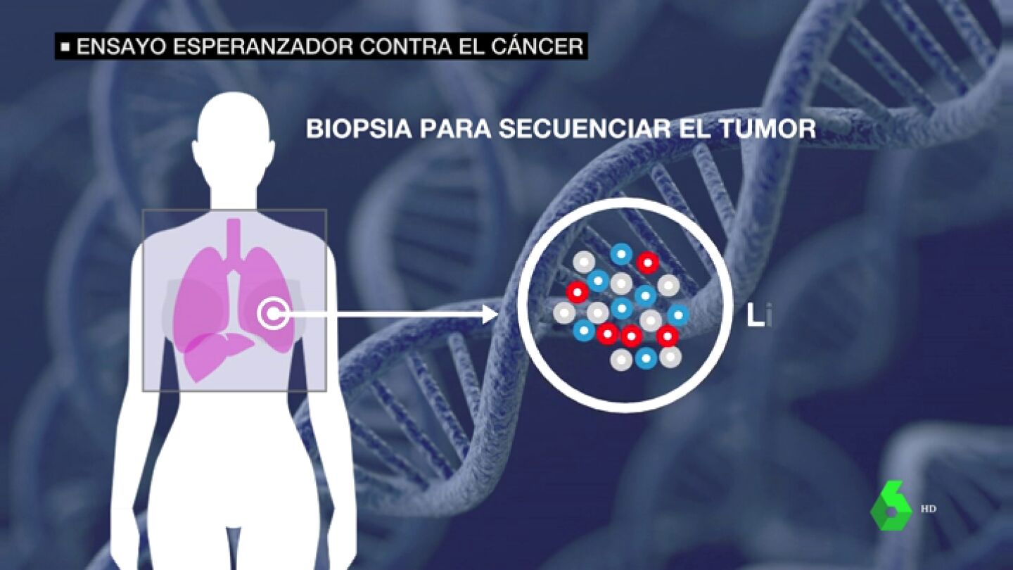 Llega a Espa&ntilde;a un ensayo esperanzador contra el c&aacute;ncer que salv&oacute; la vida a una mujer con met&aacute;stasis en EEUU