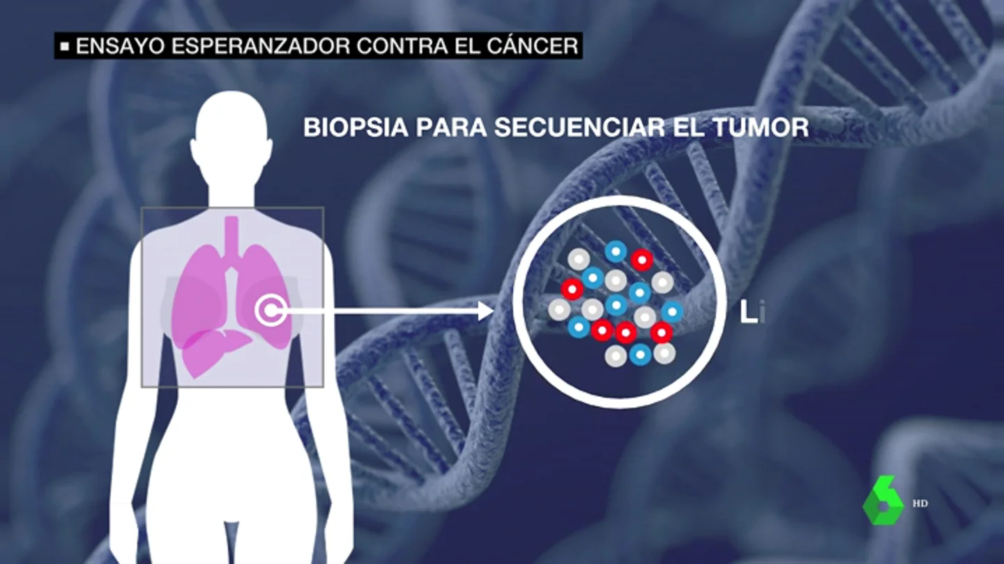 Llega a España un ensayo esperanzador contra el cáncer que salvó la vida a una mujer con metástasis en EEUU Llega a España un ensayo esperanzador contra el cáncer que salvó la vida a una mujer con metástasis en EEUU