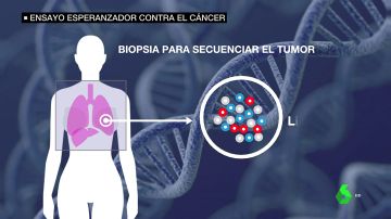 Llega a España un ensayo esperanzador contra el cáncer que salvó la vida a una mujer con metástasis en EEUU