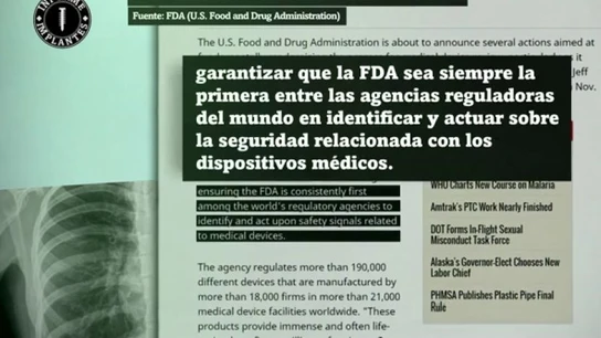 Reacción de Estados Unidos al Informe Implantes Reacción de Estados Unidos al Informe Implantes