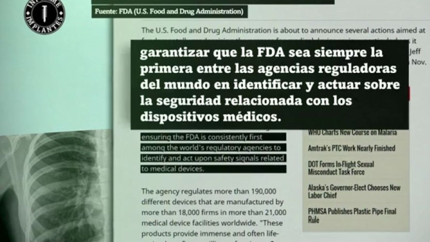 Reacci&oacute;n de Estados Unidos al Informe Implantes
