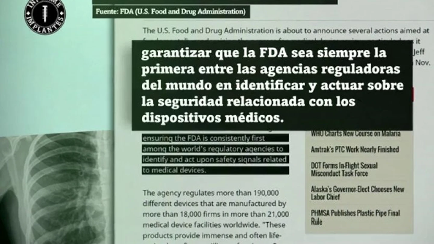 Reacción de Estados Unidos al Informe Implantes Reacción de Estados Unidos al Informe Implantes