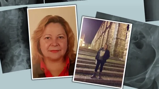 Las complicaciones por la extración del Essure causaron la muerte de una mujer de 48 años de Córdoba Las complicaciones por la extración del Essure causaron la muerte de una mujer de 48 años de Córdoba