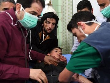 Imagen de un menor hospitalizado tras el ataque con gas cloro en Alepo Imagen de un menor hospitalizado tras el ataque con gas cloro en Alepo