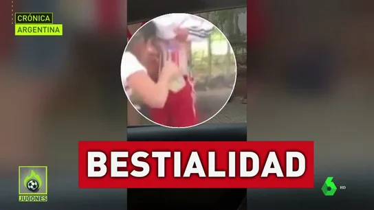 Detenida la mujer que pegó bengalas al cuerpo de su hijo Detenida la mujer que pegó bengalas al cuerpo de su hijo