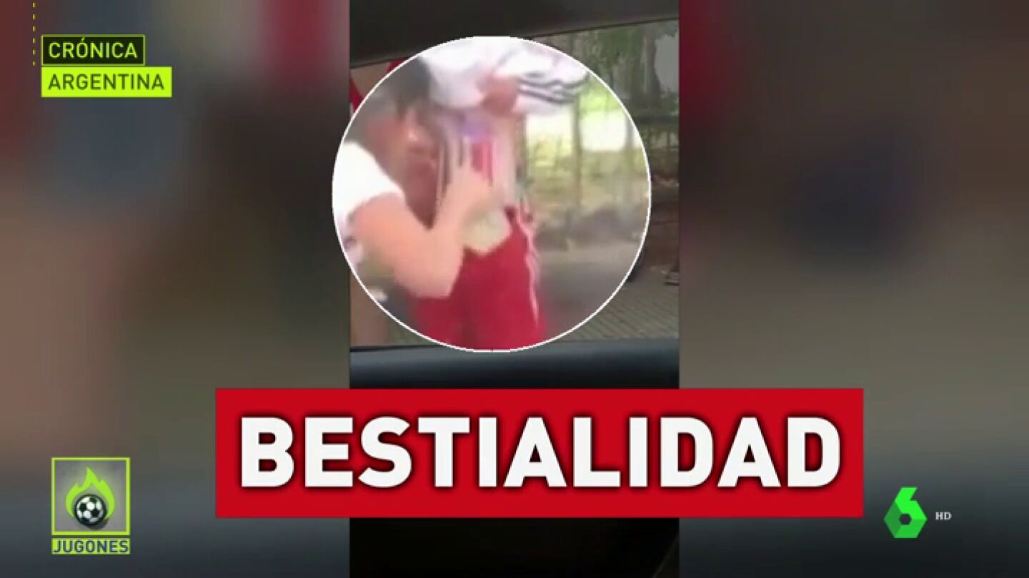 Detenida la mujer que peg&oacute; bengalas al cuerpo de su hijo