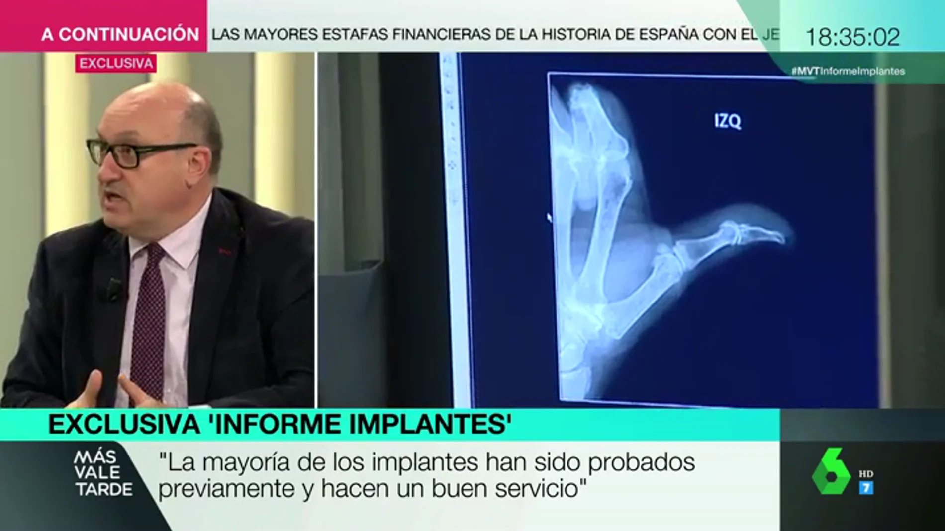 Xavier Gil, sobre los controles a los implantes defectuosos: "El problema es que el fabricante elige quién va a ser su árbitro de fútbol"