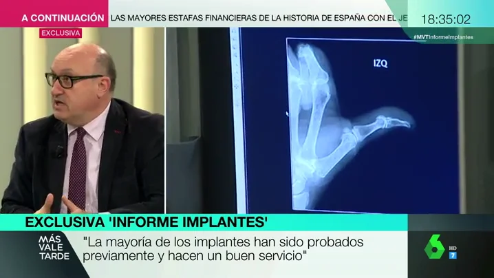 Xavier Gil, sobre los controles a los implantes defectuosos: "El problema es que el fabricante elige quién va a ser su árbitro de fútbol"