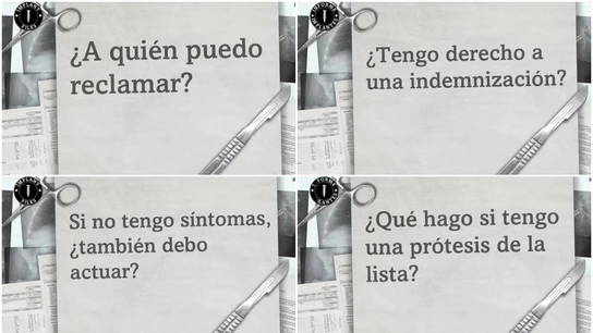 Preguntas y respuestas sobre el 'Informe Implantes' Preguntas y respuestas sobre el 'Informe Implantes'
