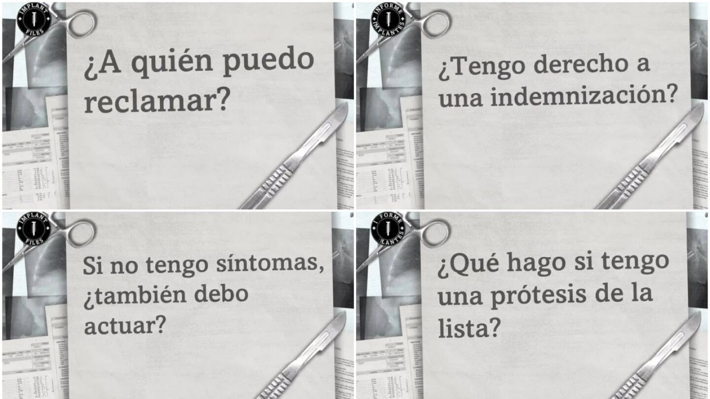 Preguntas y respuestas sobre el 'Informe Implantes'