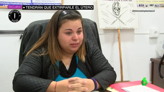 essure y mallas essure y mallas
