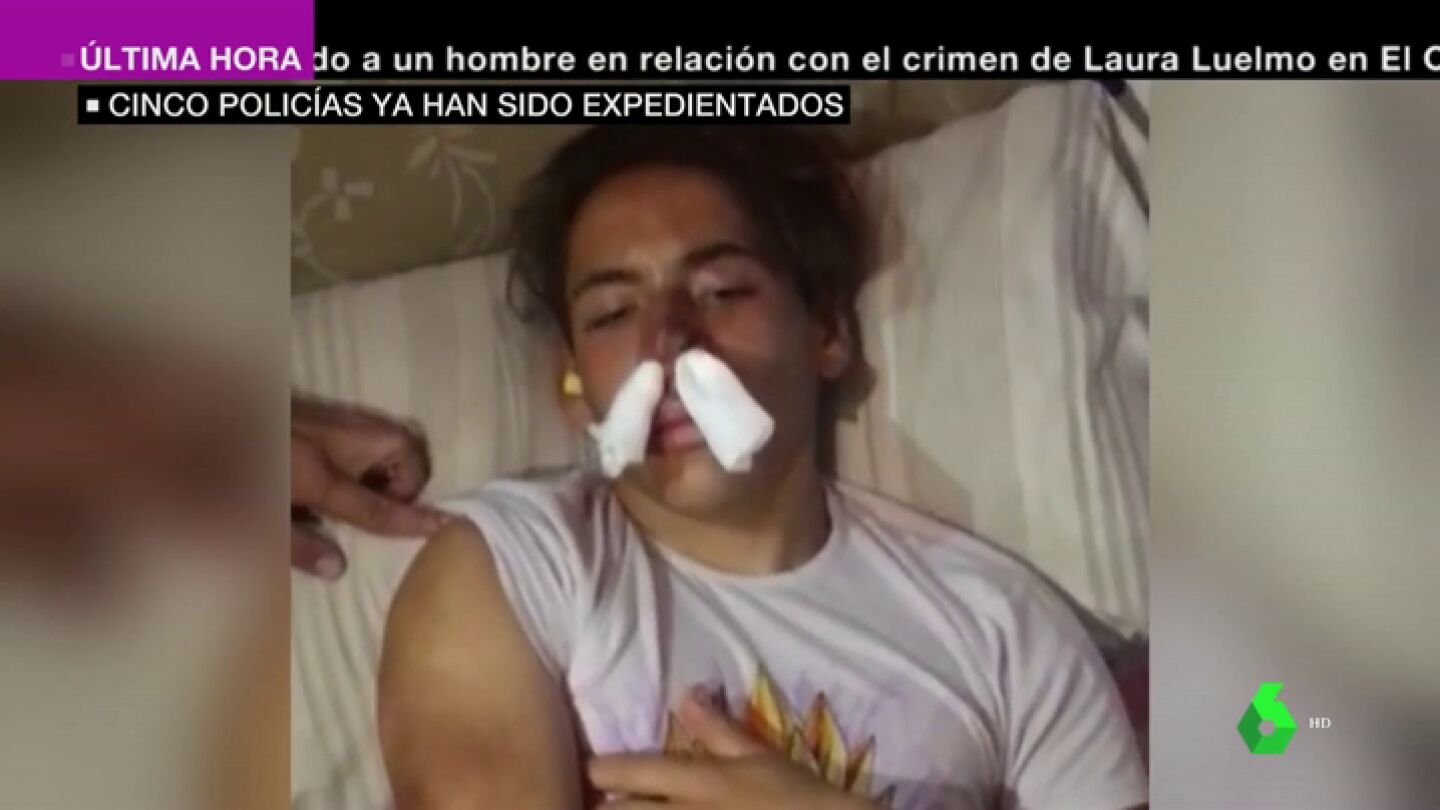 Duras im&aacute;genes: varios polic&iacute;as dan una paliza a un joven de 17 a&ntilde;os de Melilla al confundirle con un MENA
