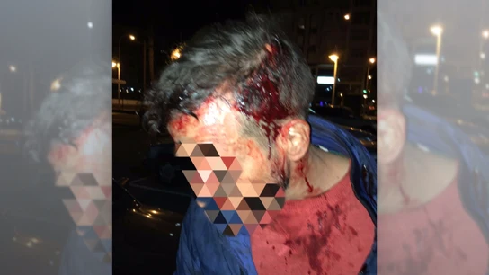 Policía herido en Melilla Policía herido en Melilla