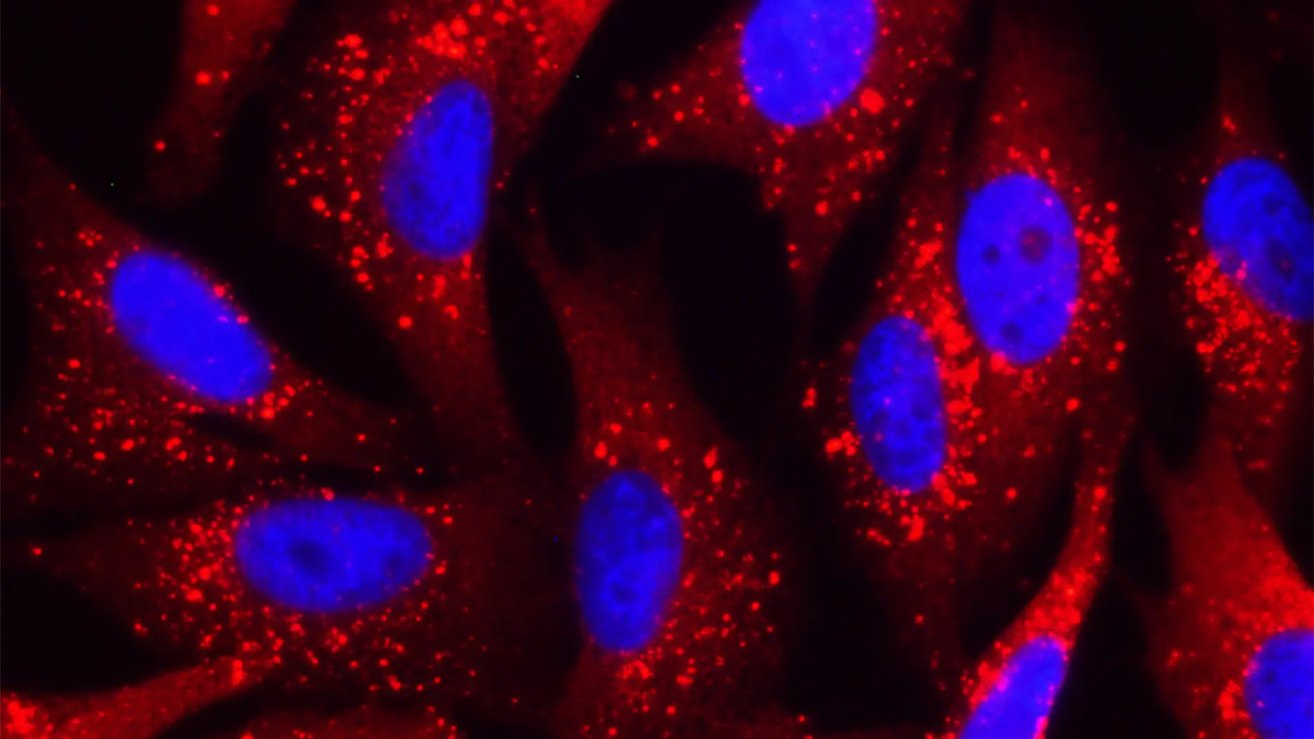 Visualización de la proteína p62 (rojo)