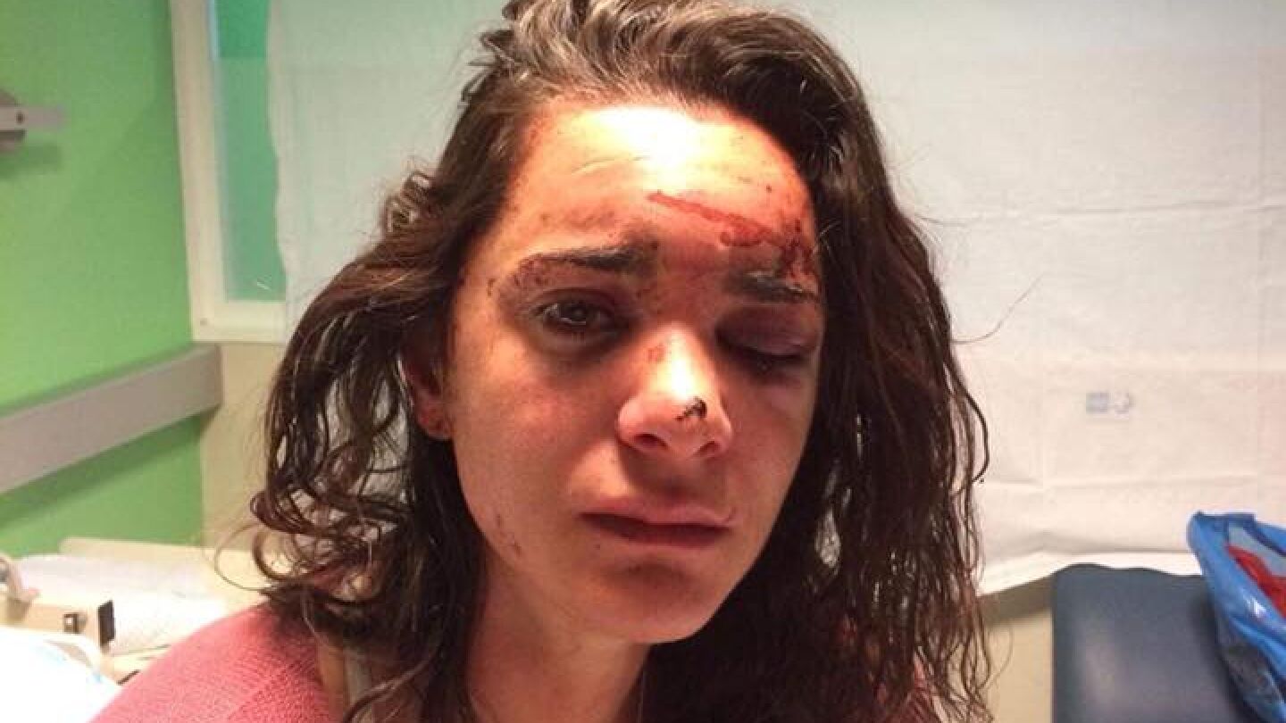 Andrea sufri&oacute; graves heridas en un ojo