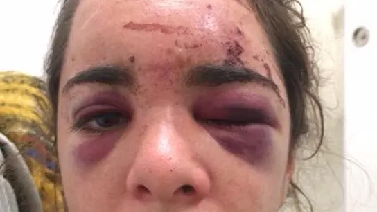 Andrea fue brutalmente apaleada y violada Andrea fue brutalmente apaleada y violada