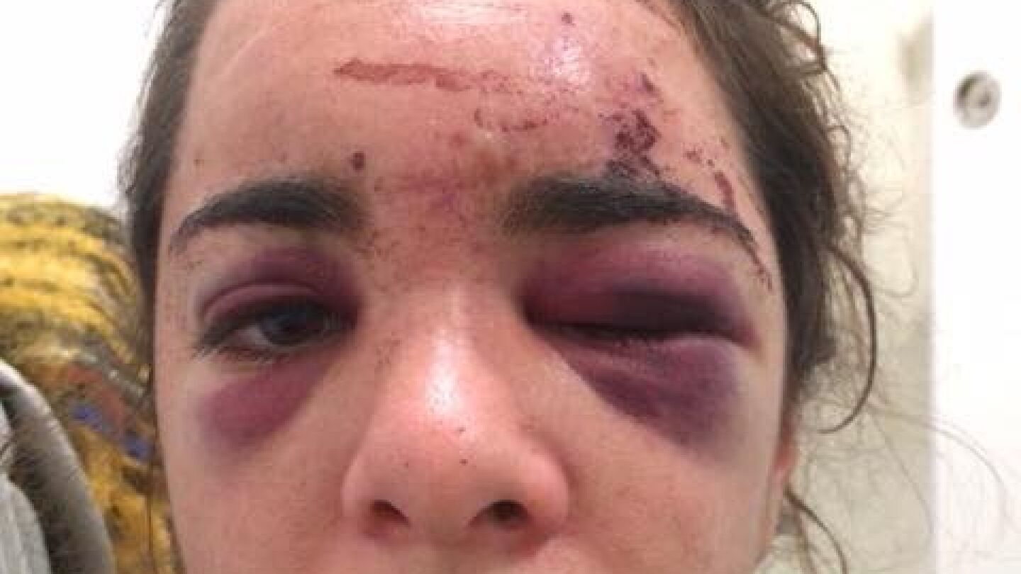 Andrea fue brutalmente apaleada y violada
