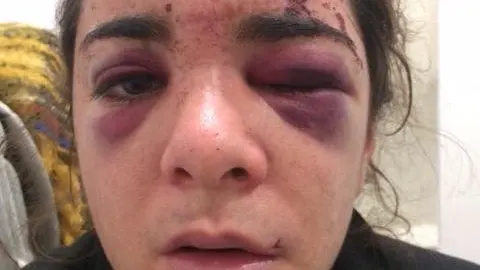 Andrea fue brutalmente apaleada y violada