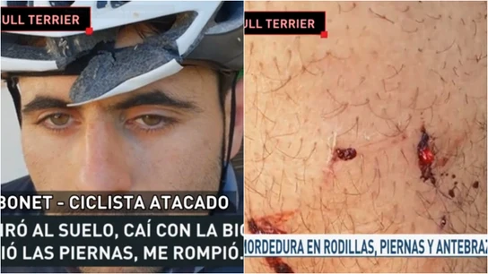 Un ciclista, atacado por un bull terrier Un ciclista, atacado por un bull terrier