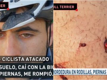 Un ciclista, atacado por un bull terrier Un ciclista, atacado por un bull terrier