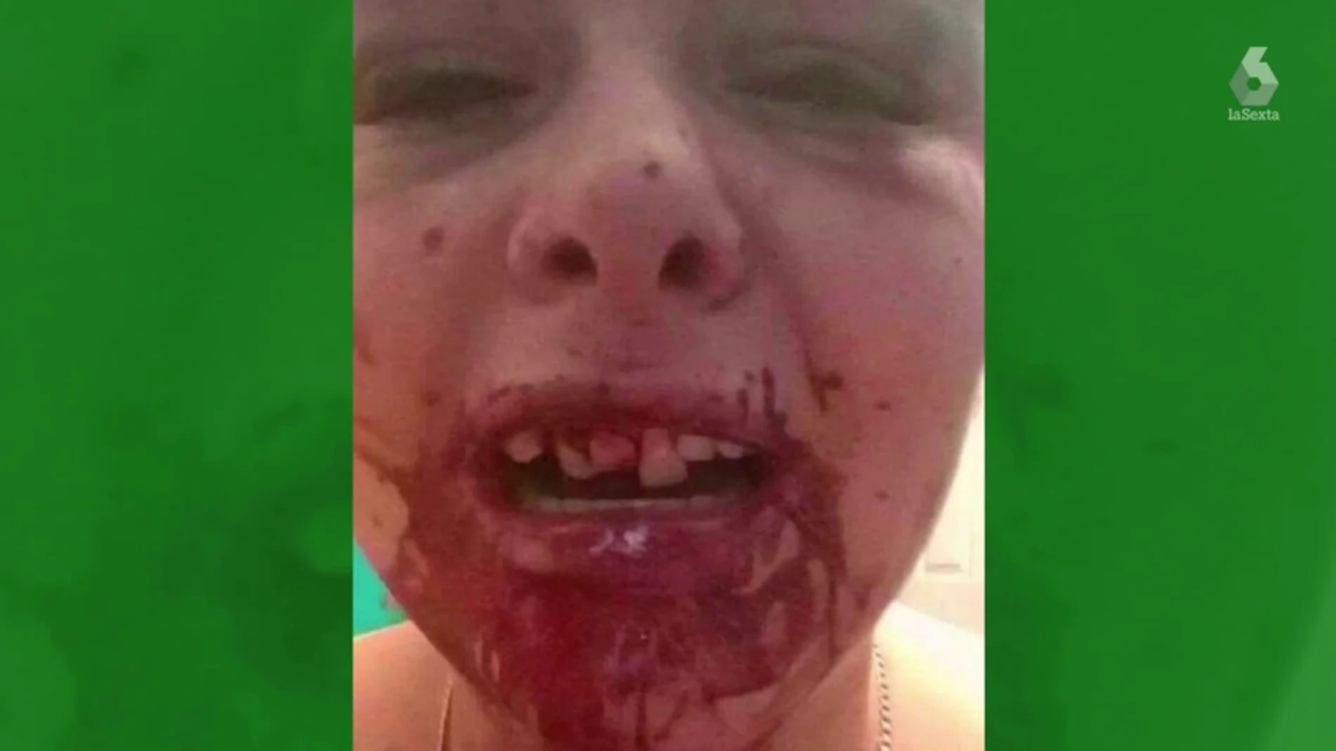 Imagen del rostro desfigurado de una joven después de que su novio le pegase una paliza