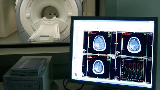 Imagen de un tumor cerebral  Imagen de un tumor cerebral