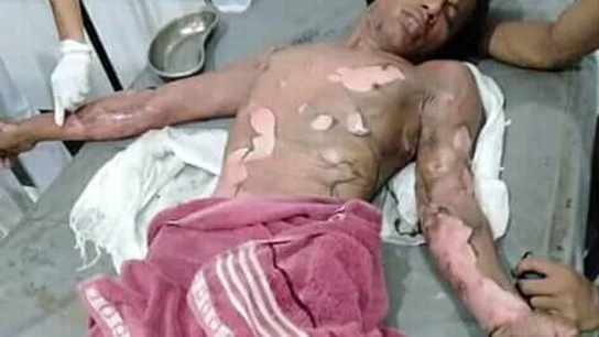 Una mujer quema vivo a su marido porque no le daba la contraseña del móvil Una mujer quema vivo a su marido porque no le daba la contraseña del móvil