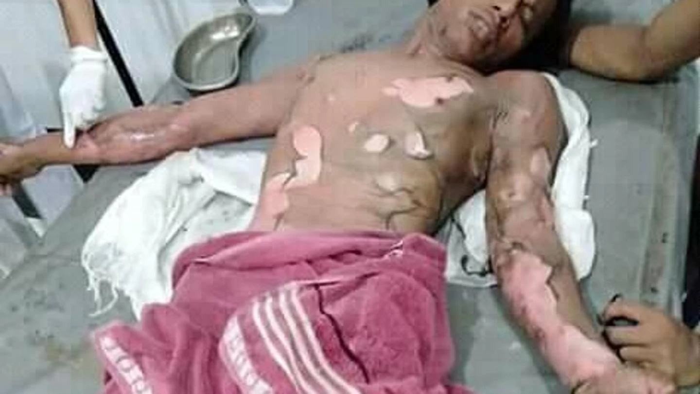 Una mujer quema vivo a su marido porque no le daba la contraseña del móvil Una mujer quema vivo a su marido porque no le daba la contraseña del móvil