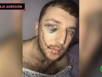 Las terribles heridas de un seguidor del Everton al que rajaron la cara en una pelea entre hooligans: "No me puedo mirar en el espejo" Las terribles heridas de un seguidor del Everton al que rajaron la cara en una pelea entre hooligans: "No me puedo mirar en el espejo"