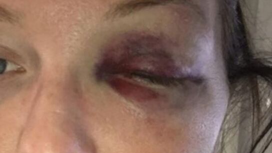 Leanne Barrett, v&iacute;ctima de violencia machista