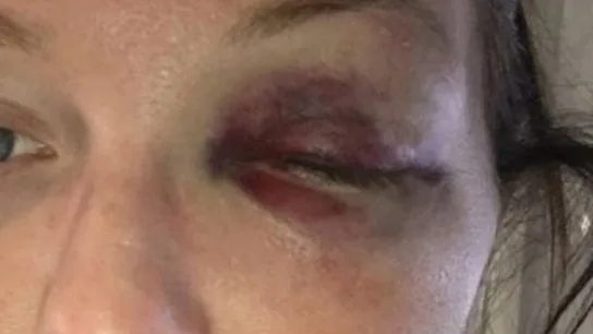 Leanne Barrett, víctima de violencia machista Leanne Barrett, víctima de violencia machista