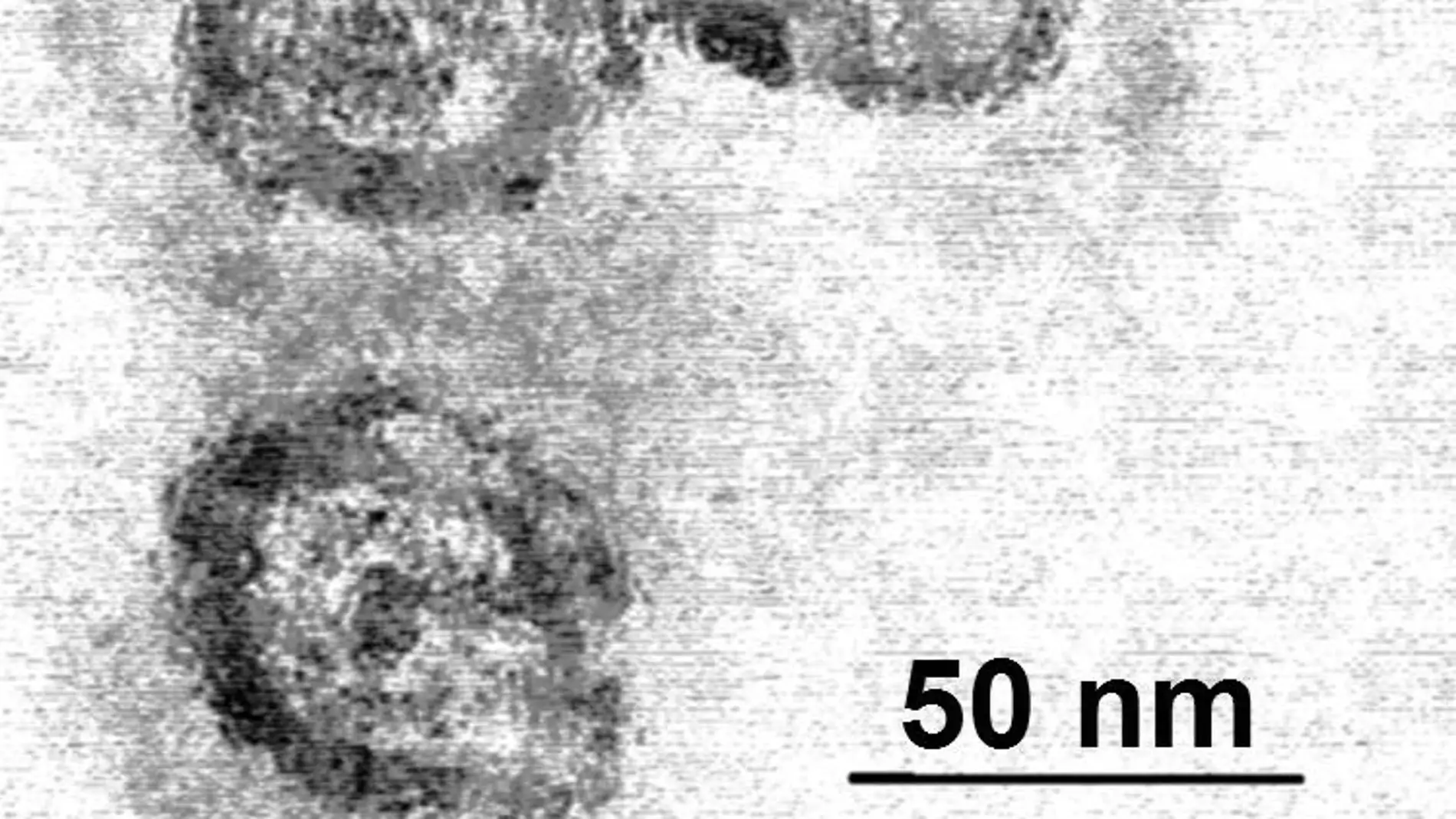 virus de la hepatitis C