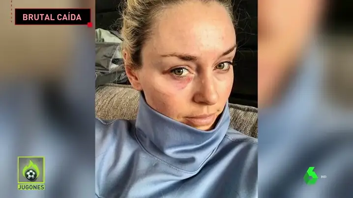 Lindsey Vonn, tras su escalofriante caída: "Sentí como si me golpeara un camión"