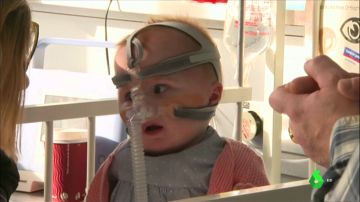 La bebé que nació con el corazón fuera del pecho recibe el alta tras superar tres operaciones 