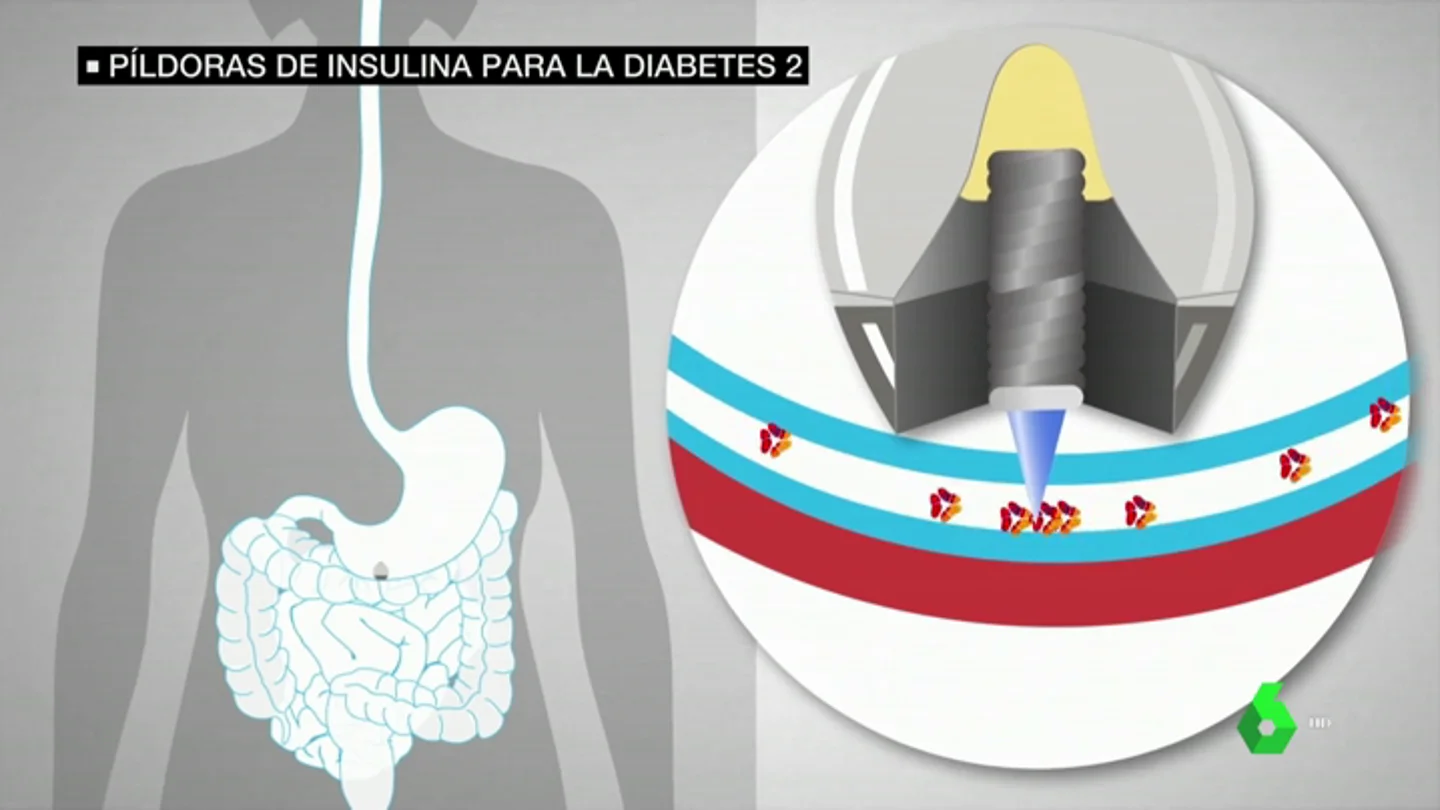 Una píldora de insulina podría acabar con las inyecciones en la diabetes tipo 2 Una píldora de insulina podría acabar con las inyecciones en la diabetes tipo 2