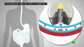 Una píldora de insulina podría acabar con las inyecciones en la diabetes tipo 2