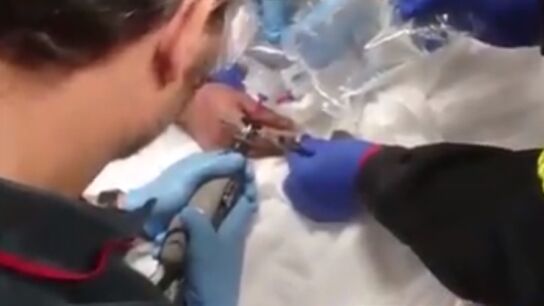 Corte de precisi&oacute;n para quitar el anillo de un hombre