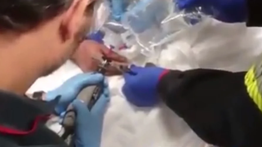 Corte de precisión para quitar el anillo de un hombre Corte de precisión para quitar el anillo de un hombre