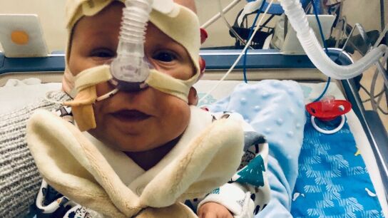 George Roses, el peque&ntilde;o beb&eacute; prematuro