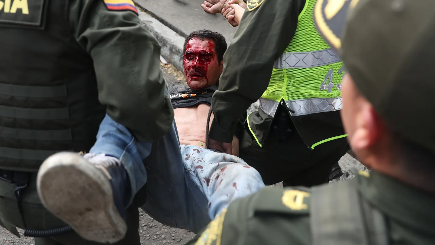 Un herido es socorrido por miembros de la Policía de Colombia Un herido es socorrido por miembros de la Policía de Colombia